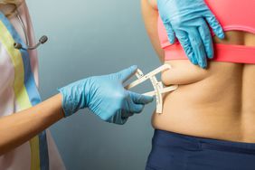 A doctor using a caliper to calculate a person's body fat