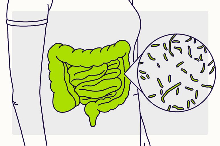 Illustration of diarrhea