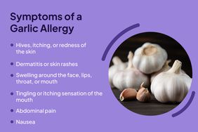 Symptoms of a Garlic Allergy Composite