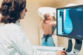 woman undergoing mammogram