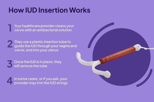 IUD Insertion Composite