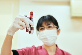 nurse collecting sample of lymphocytes