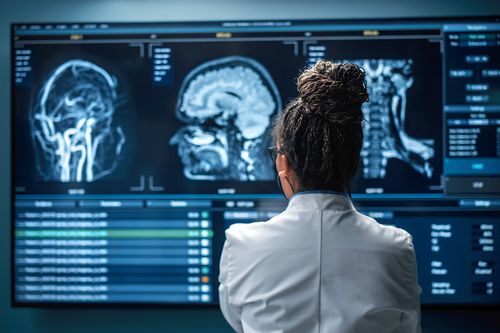 Medical Hospital Research Lab: Black Female Neuroscientist Looking at TV Screen, Analyzing Brain Scan MRI Images, Finding Treatment for Patient. Health Care Neurologist Curing People